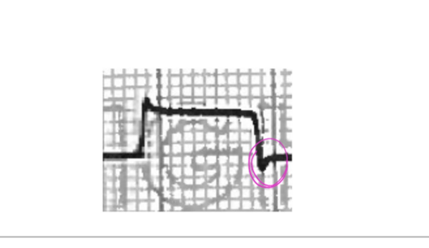 <p>Glissade (Pic)</p>