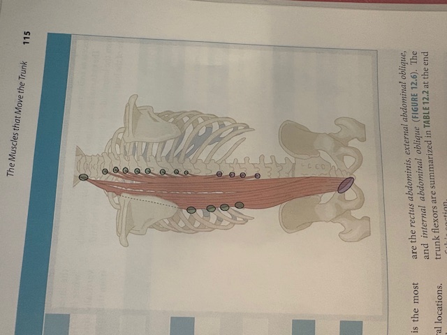 <p>Erector Spinae</p>