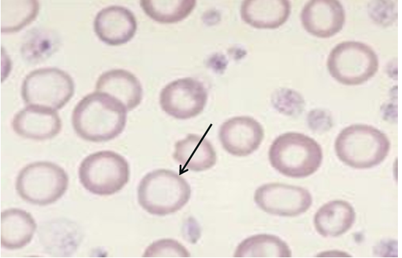 <p>What cell is this arrow pointing to?</p>