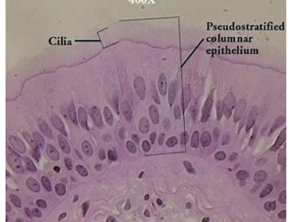 <p>pseudostratified epithelium</p>