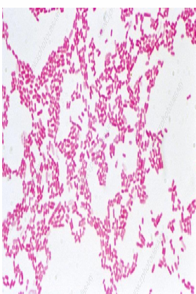 <p>E. coli inhabits the normal intestinal flora. They are Gram negative bacilli, motile, and non sporulated. They are facultative anaerobes and produce rose pink colonies on MacConkey’s agar.</p>