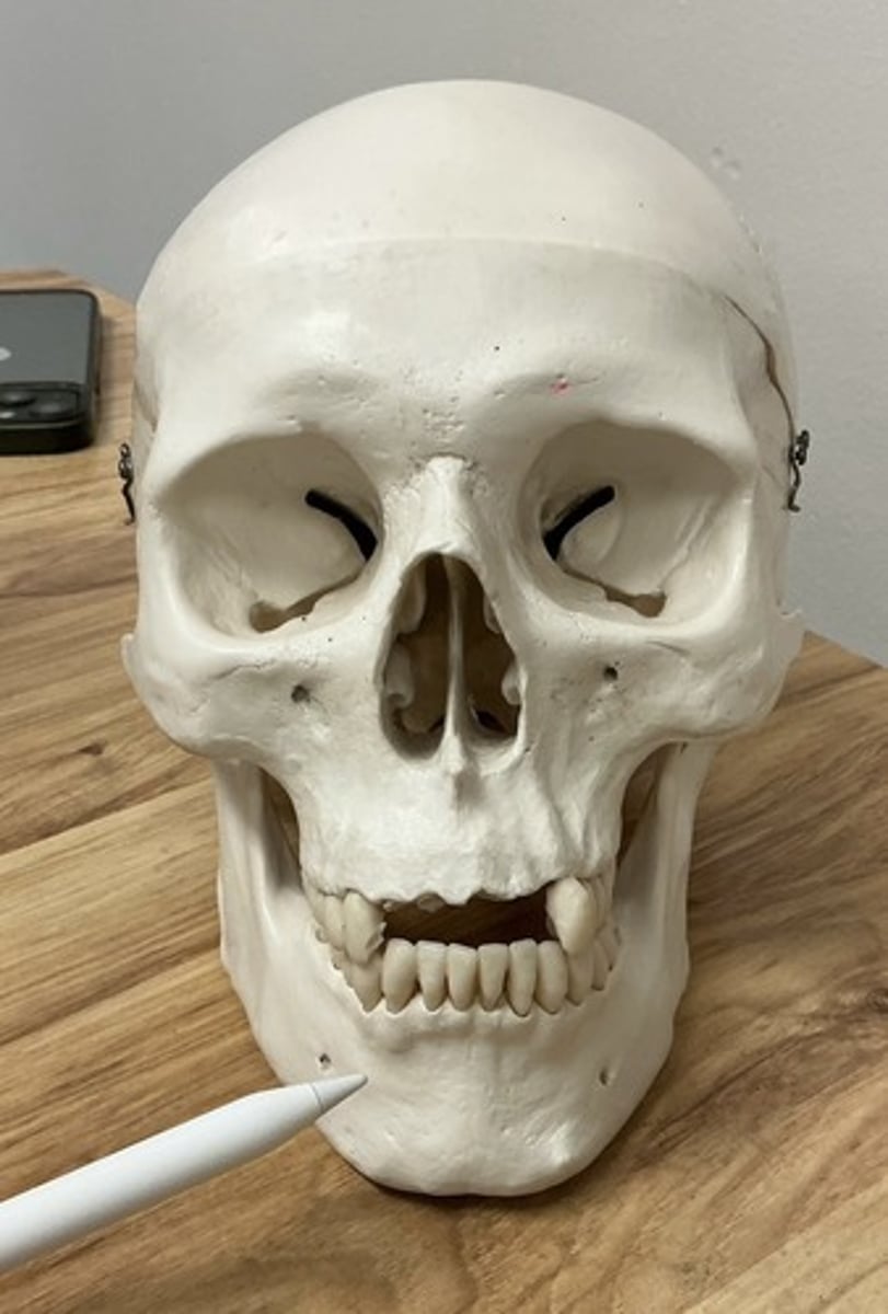 <p>What bone is this?</p>