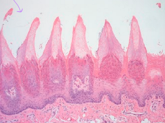 <p>What type of papilla is this?</p>