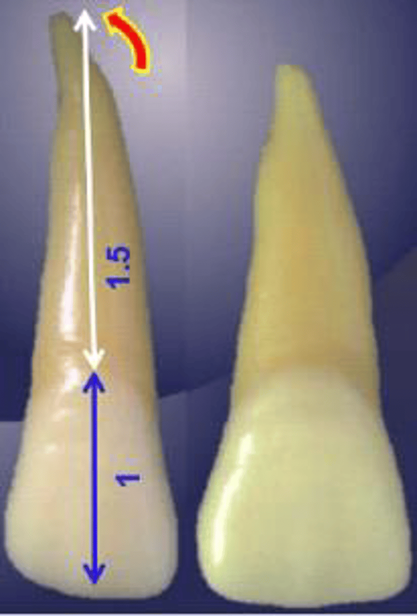 <p>what tooth is this?</p>