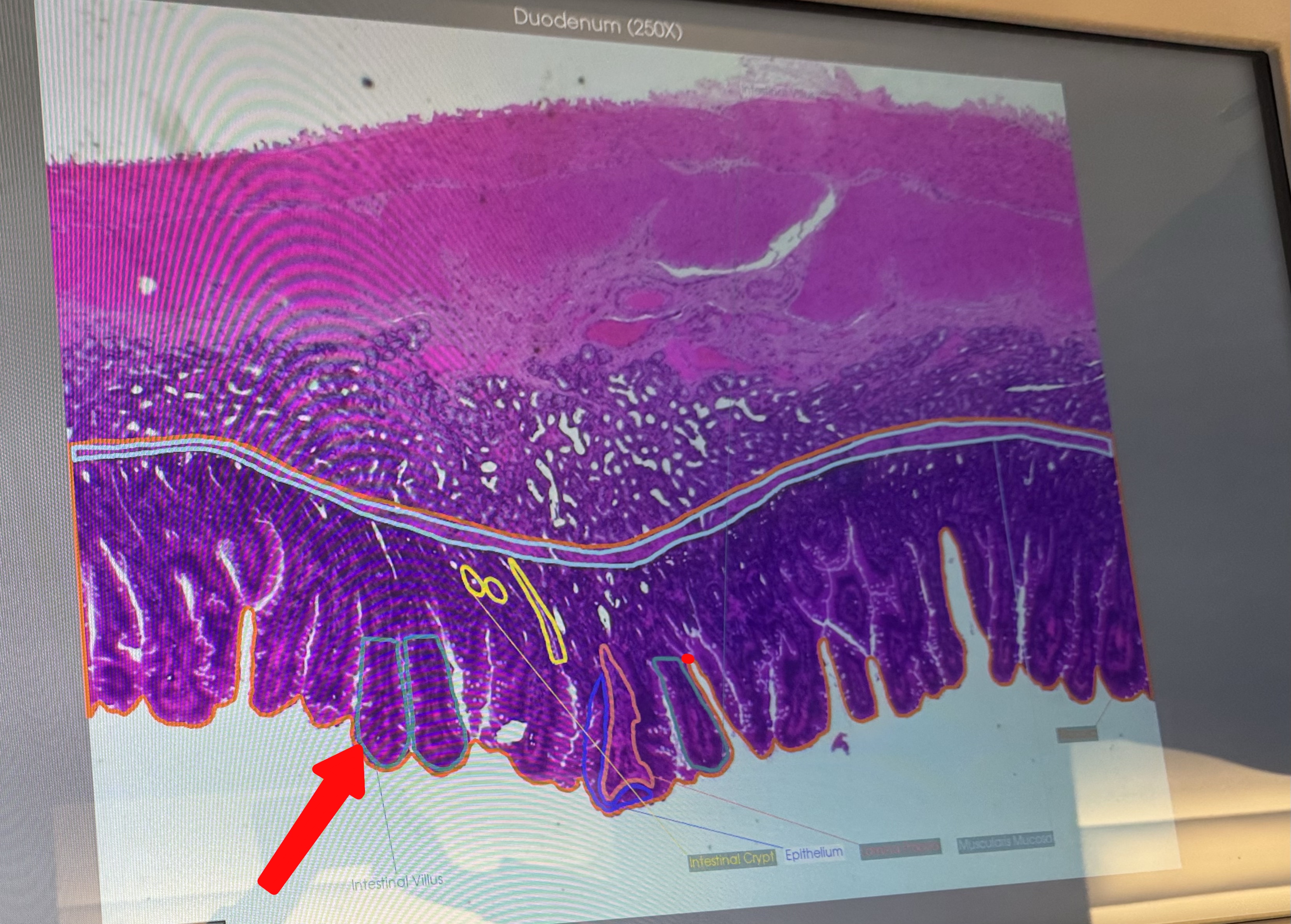 <p><span>Duodenum (#10152): what is this structure? </span></p>