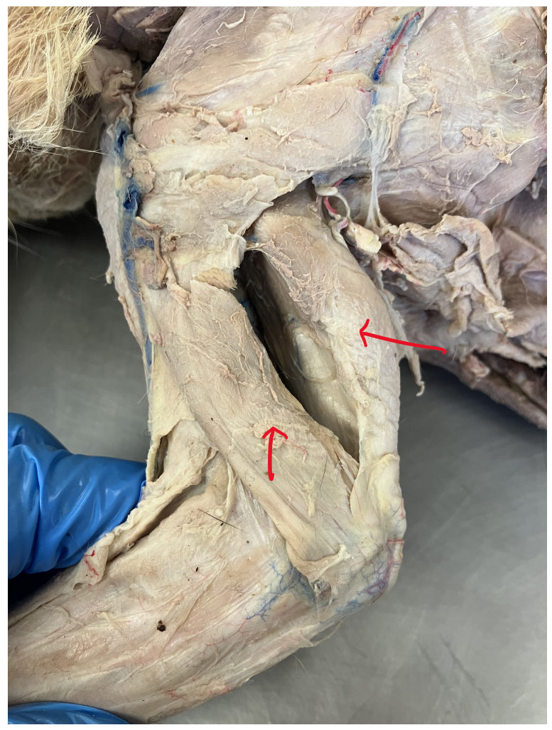 <p>What structure is identified by the bottom arrow? </p>