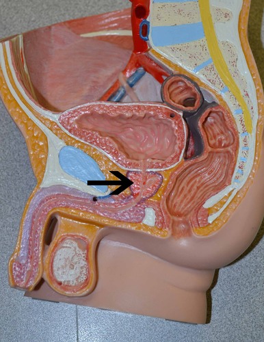 <p>This area of male reproductive anatomy is the source of acid phosphatase (AP) and prostate specific antigen (PSA), which are components of seminal plasma. It is often followed with the word &quot;gland.&quot;</p>