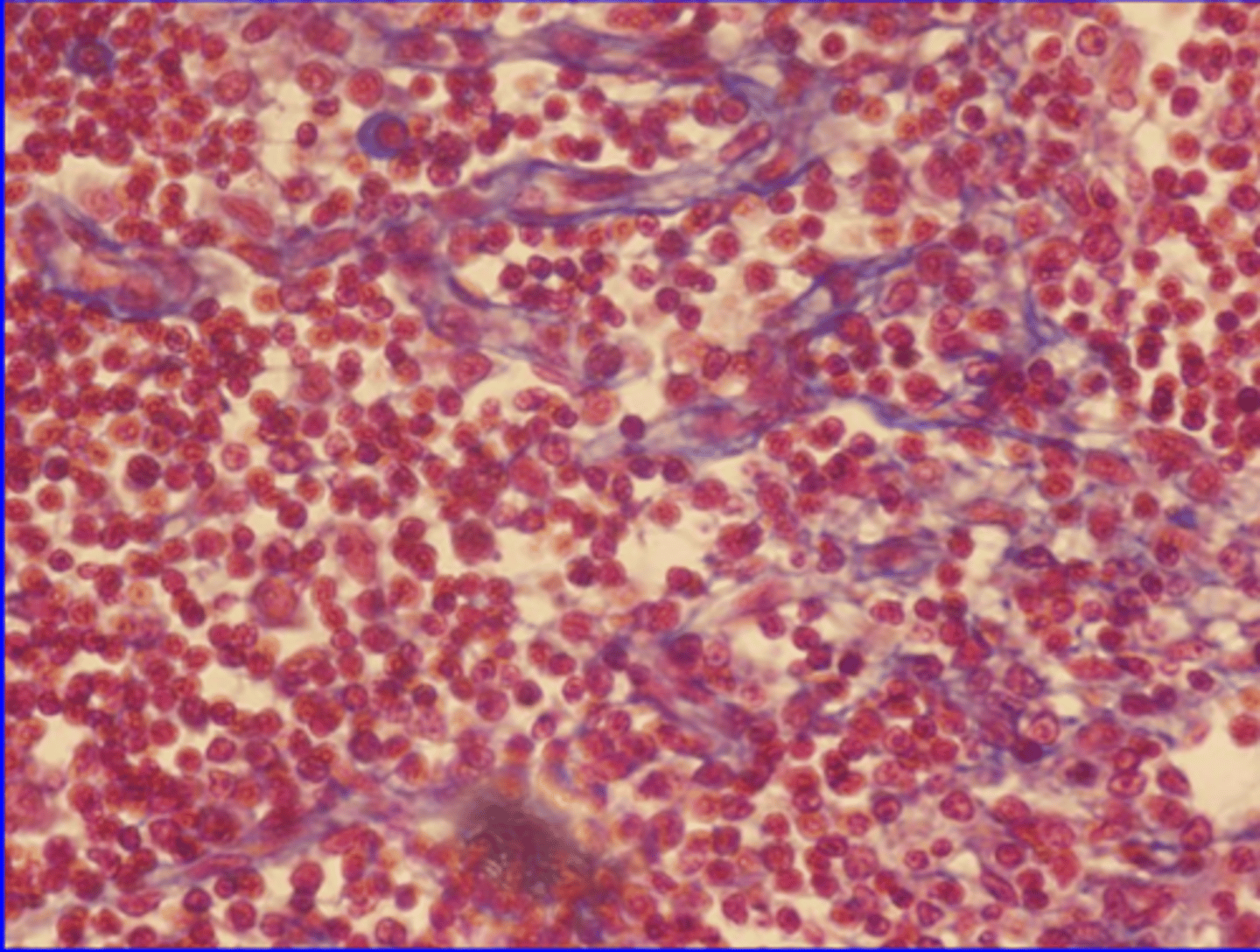 <p>Cell type: lymphocytes</p><p>Fiber type: reticulin</p><p>Function: structural support</p><p>Location: Found supporting the soft structure of thelymphoid organs (lymph nodes, bone marrow, and spleen</p>