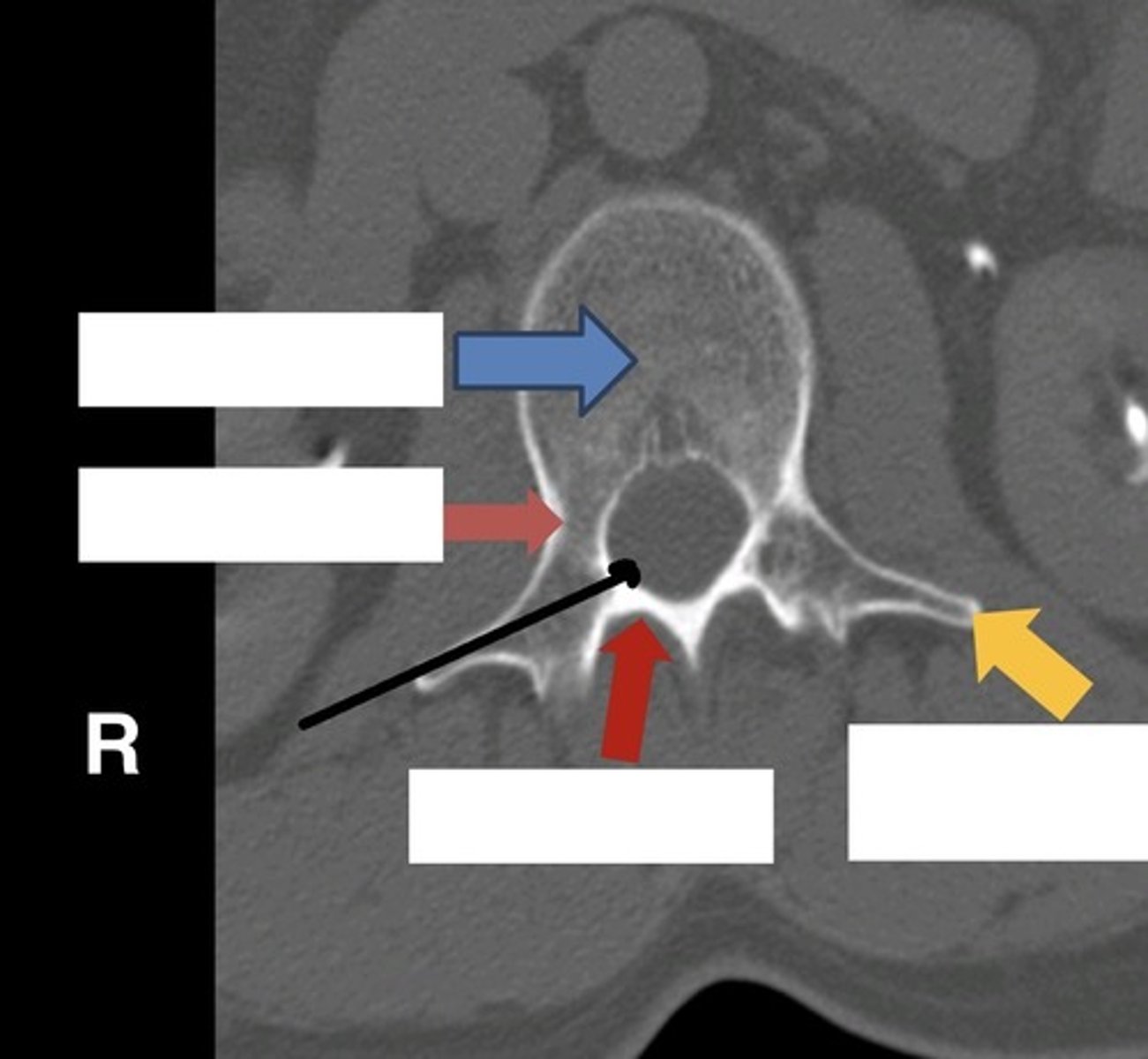 <p>what is the yellow arrow pointing to?</p>