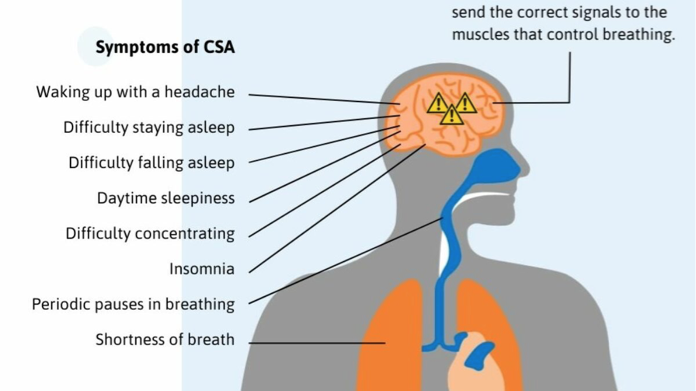 <p>Pathophysiology of central sleep apnea</p>
