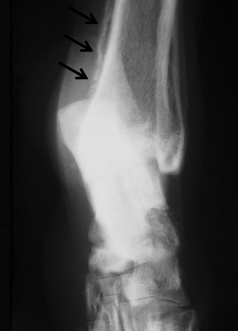 <p><span style="background-color: transparent;"><strong>Renal Tumors</strong></span></p>