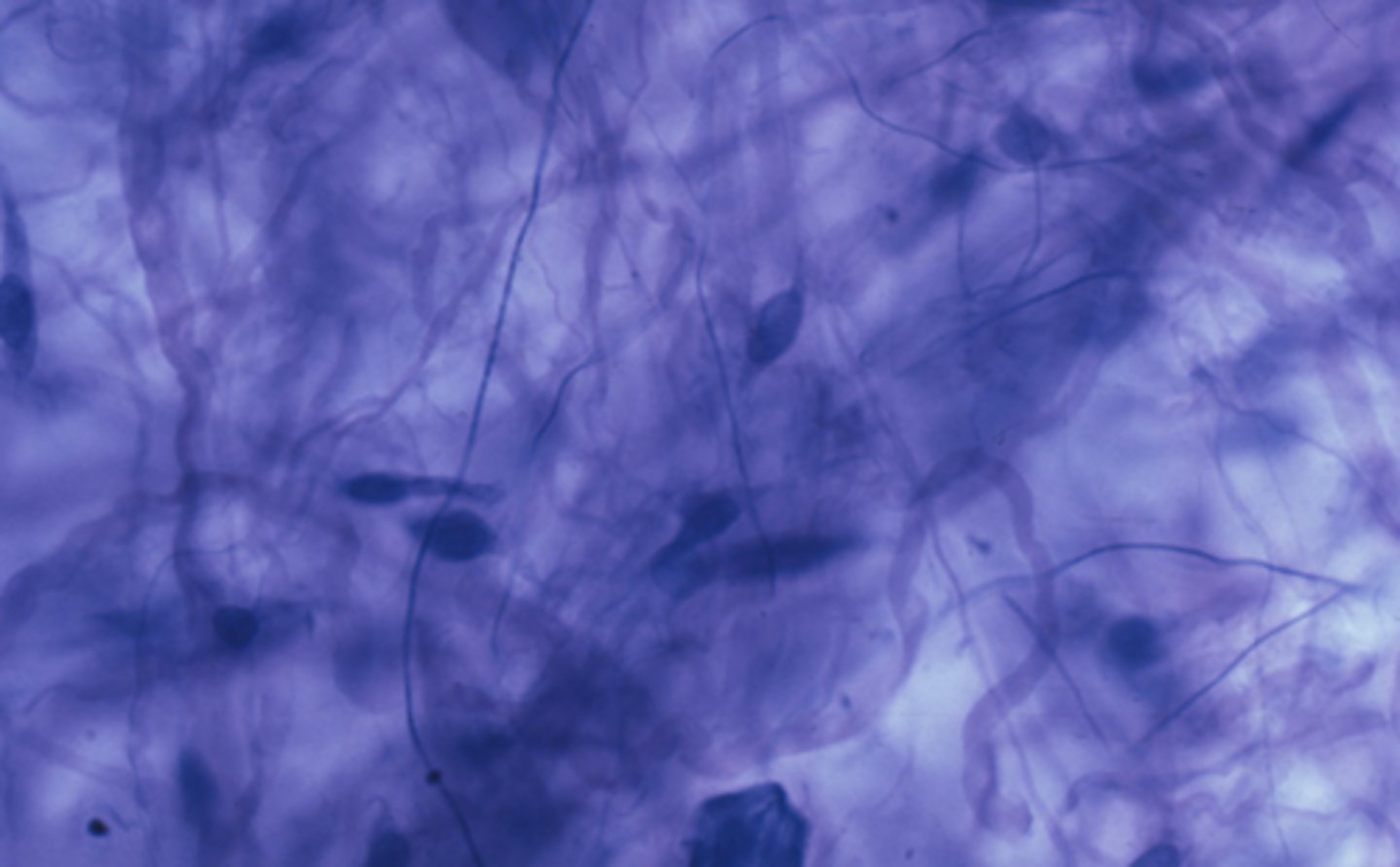 <p>Which is a characteristic of the tissue type in the previous image: Connective Tissue</p><p>Cells produce an extracellular matrix</p><p>Cells are contractile</p><p>Cells have an apical and basolateral surface</p><p>Cells conduct electrochemical impulses</p>