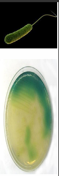 <p>What are some general characteristics of Pseudomonas?</p>