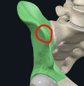<p>What is this called?</p>