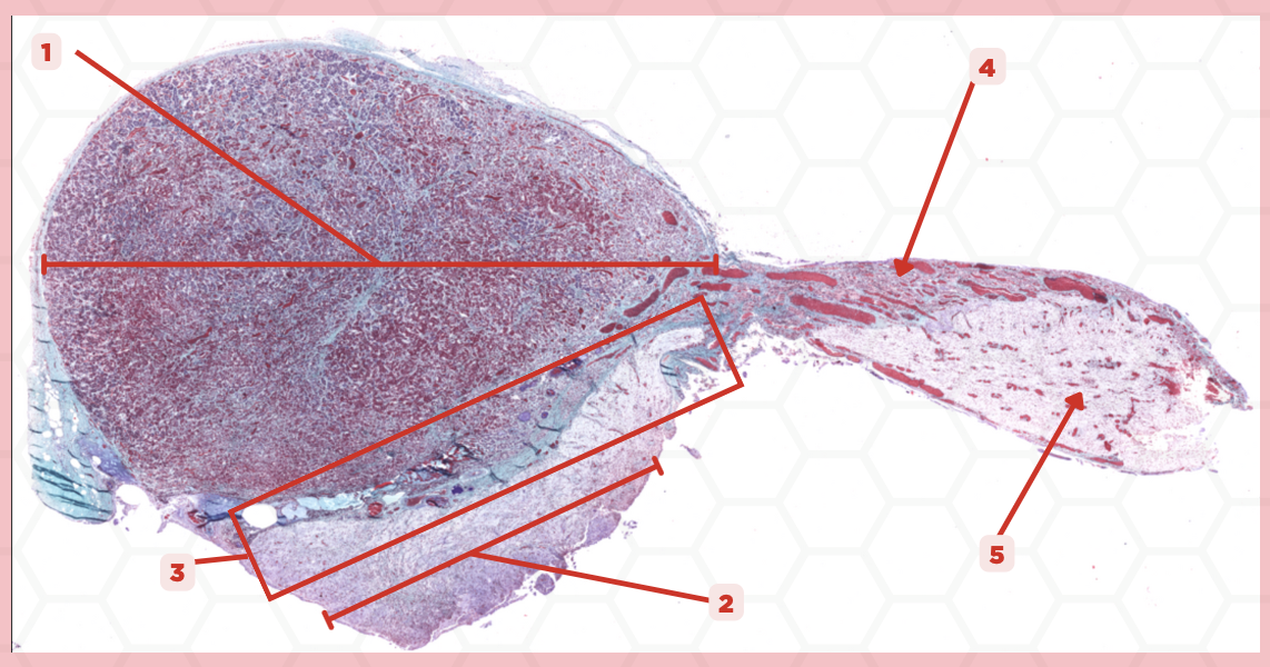 <p>What ectoderm #1, #3, &amp; #4 derived from?</p>