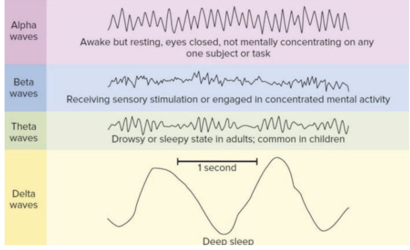 <p>very regular, high amplitude and slow waves - deep sleep - disconnected from outside sensory world</p><p>stage 3+4, 4 is the longest stage of sleep</p>
