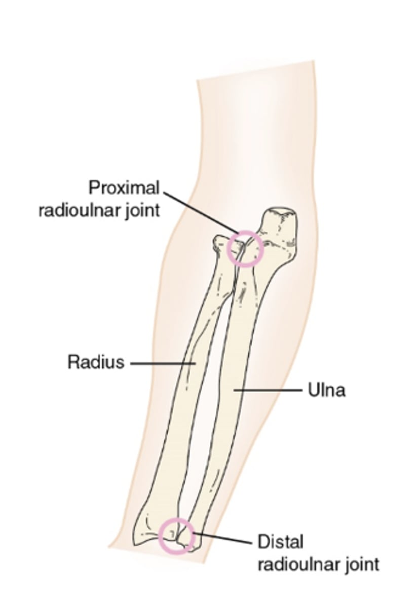 <p>proximal articulation of the <strong>radial notch of ulna </strong>+<strong> head of radius</strong></p><ul><li><p><strong>convex</strong>: head of radius</p></li><li><p><strong>concave</strong>: radial notch of ulna</p></li><li><p>synovial joint</p></li><li><p>uniaxial- allowing only pronation and supination of the forearm</p></li></ul><p></p>