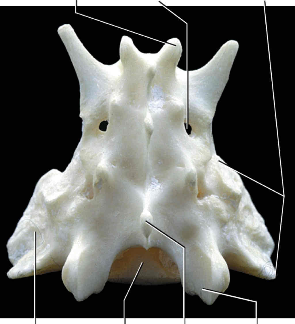 <p>What type of vertebra is this?</p>
