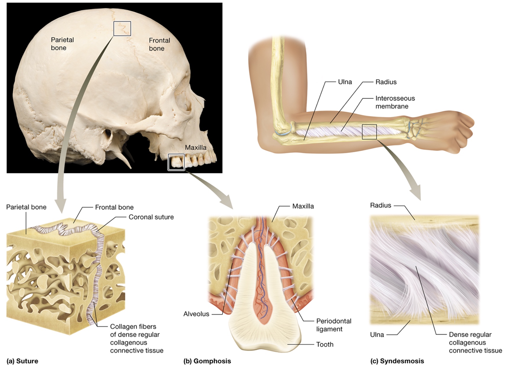 <p>fibrous joints</p>