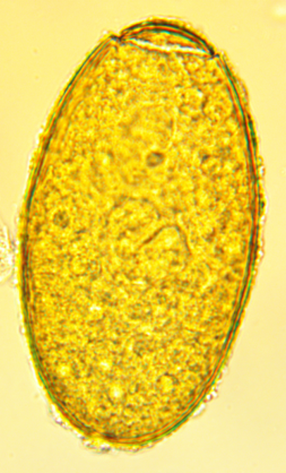 <p><strong>Fasciola hepatica</strong></p>