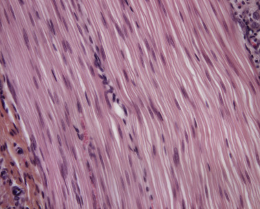 <p>what kind of tissue is this </p>