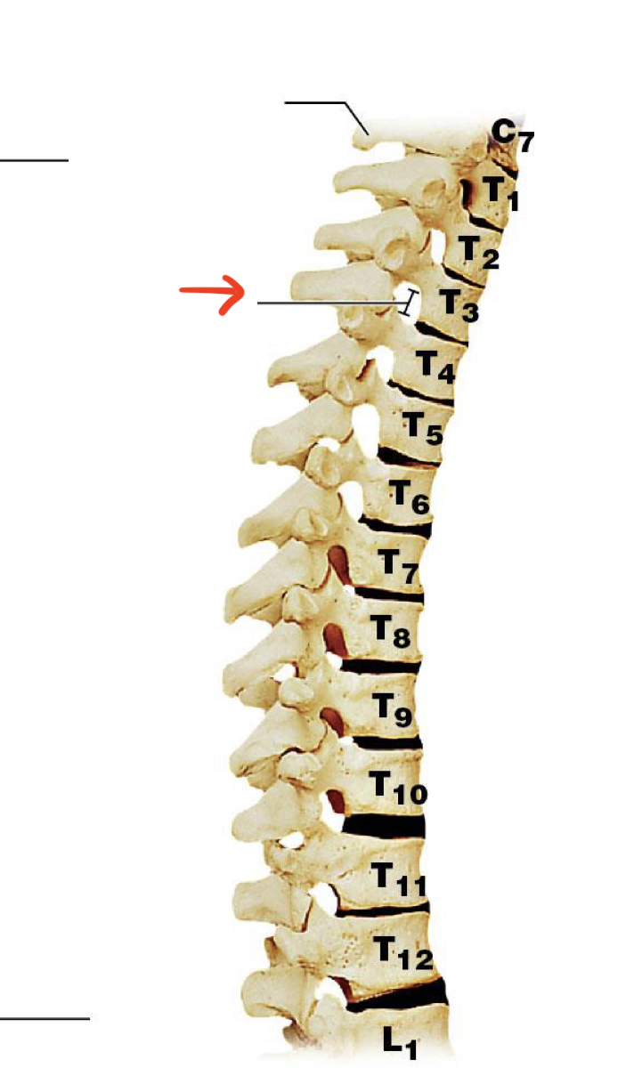 <p>small openings formed on lateral side of vertebral column. formed when 2 vertebra stacked on top of each other</p>