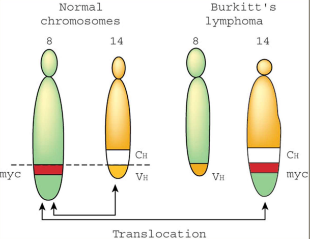 Burkitt's lymphoma
- Has recurring reciprocal translocation btwn q-arms of chromosomes 8 &14