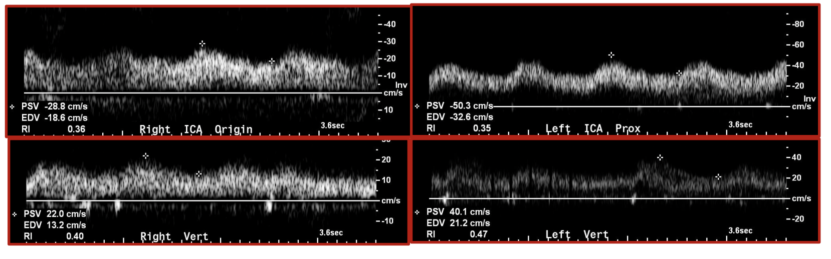 <p>When would you expect this waveform? </p>