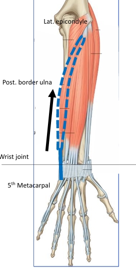 <p>Name this muscle</p>