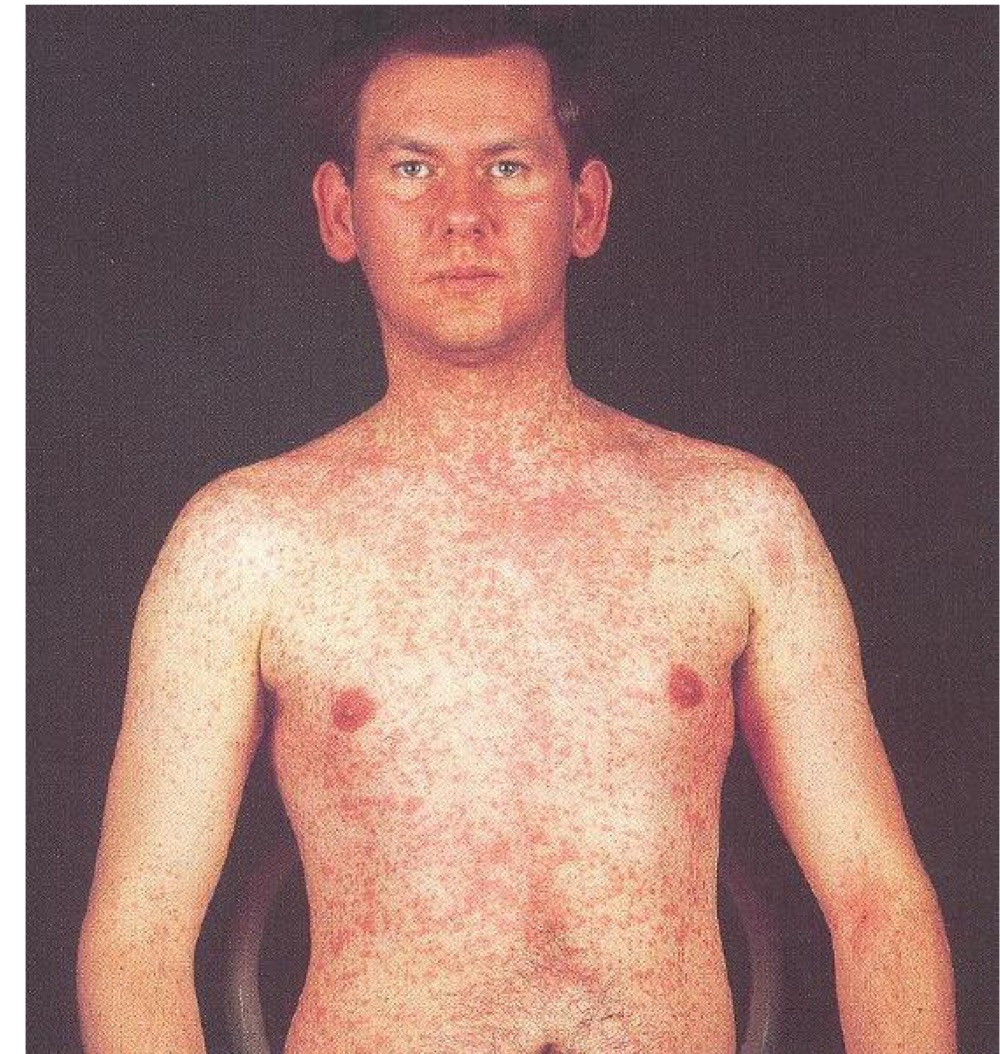 <p>what infection is this?</p>