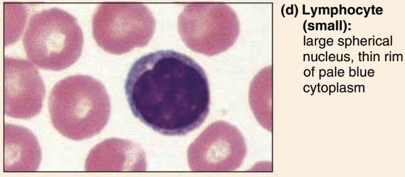 <ul><li><p>classic= oval/round nucleus, scant cytoplasm</p></li></ul><p></p>