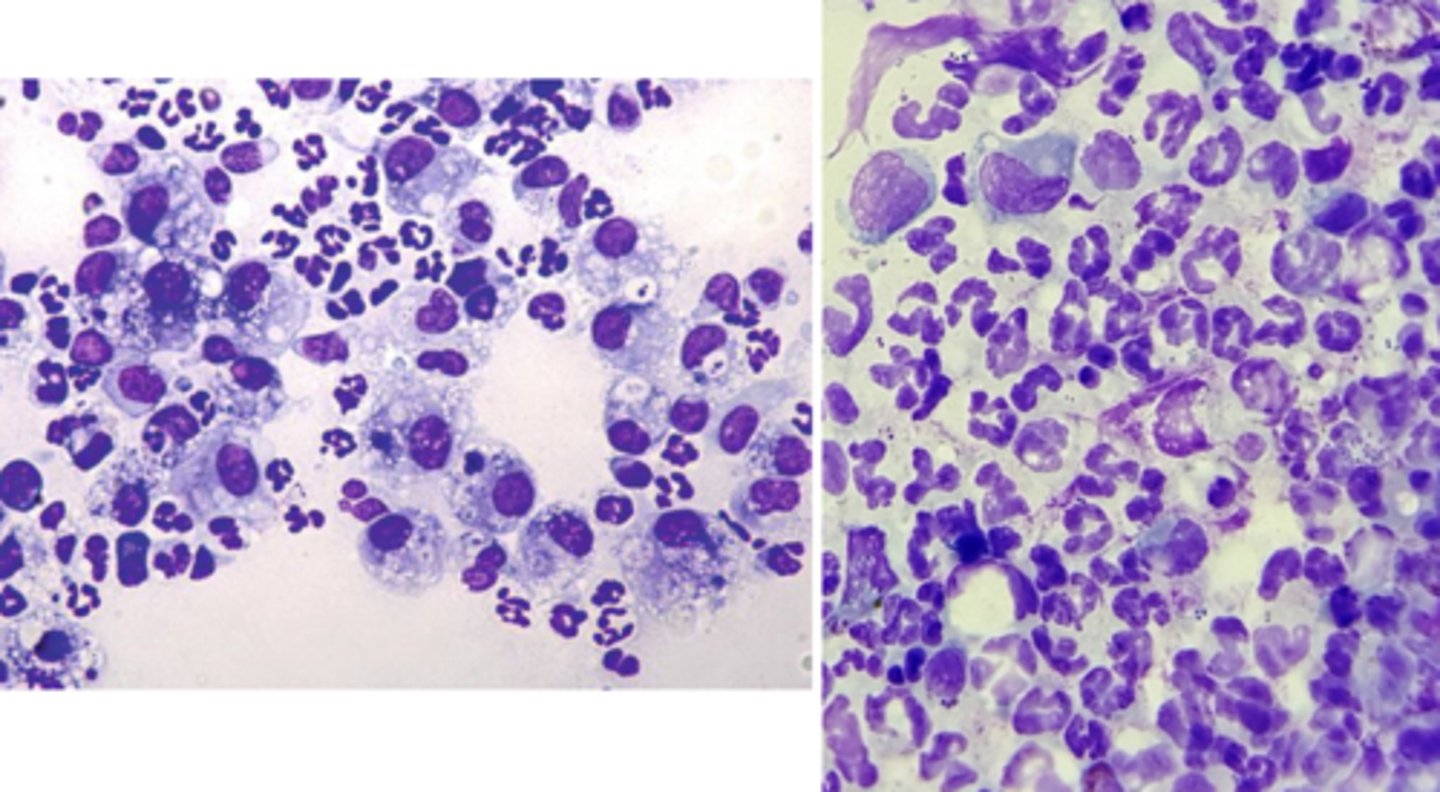 <p>What type of inflammation is this?</p>