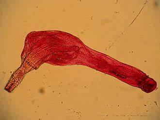 <p>Acanthocephalan</p>