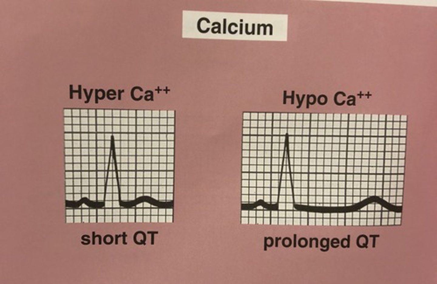 <p>Hypocalcemia denotes a lower than average amount of calcium, while hypercalcemia is an overabundance of calcium.</p>