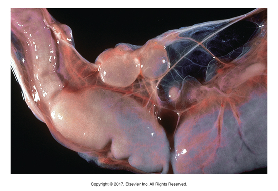 <p>“Canine/dog bladder worm”</p><ul><li><p>Affects: Dogs, adults in small intestine</p></li><li><p>Intermediate host: cattle, sheep, goats​</p></li><li><p>Found in: Worldwide​</p></li><li><p>Cause of infection: Ingestion of omentum of ruminants with golf-ball size cysticercus (not pathogenic to ruminants)​</p></li><li><p>Armed scolex, proglottids have single lateral genital pore​</p></li><li><p>Eggs can be seen in fecal flotation</p></li></ul><p></p>