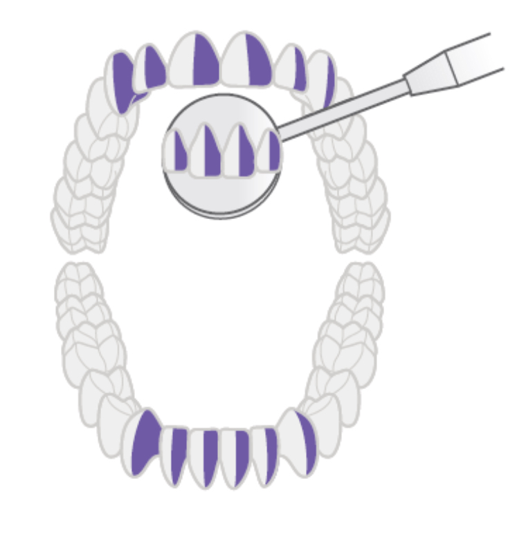 <p><strong>What anterior surface is this to the clinician and what clock position?</strong></p>