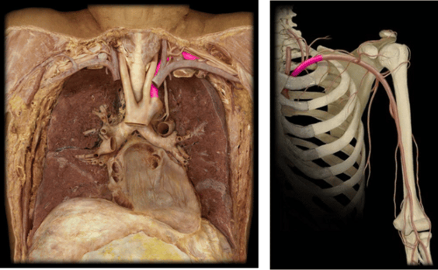 <p>Name this specific vessel (include the side).</p>