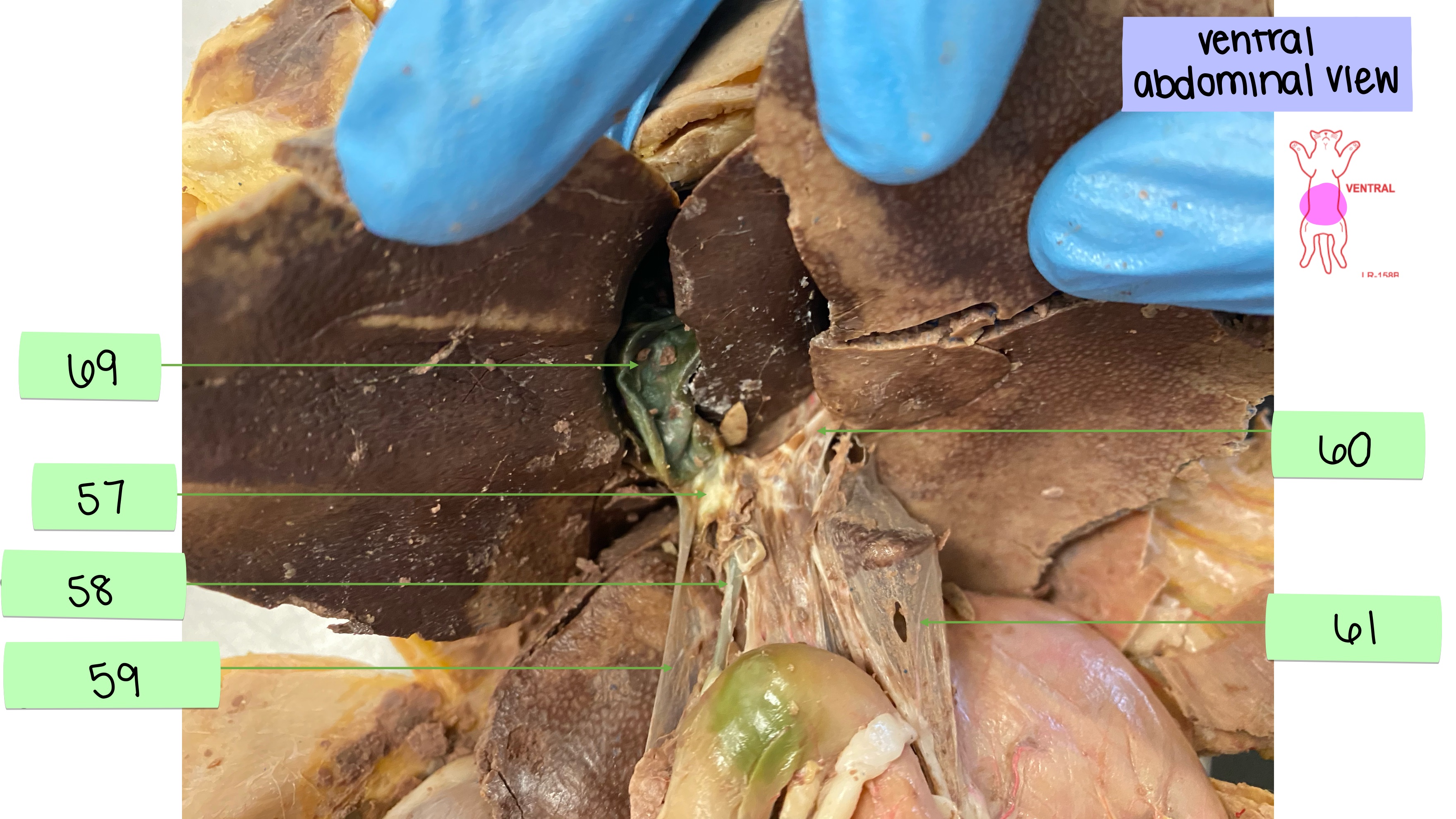 <p>hepatoduodenal ligament</p>