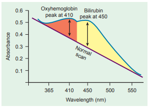 Figure 3: Spectrophotometric bilirubin scan showing bilirubin and oxyhemoglobin peaks.