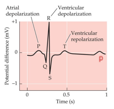 Ventricular depolarization.
