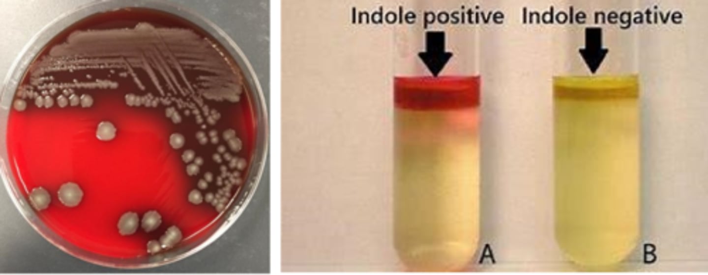 <p>Lactose fermentation</p><p>Voges Proskauer negative</p><p>Many beta- hemolytic</p><p>Indole positive</p>