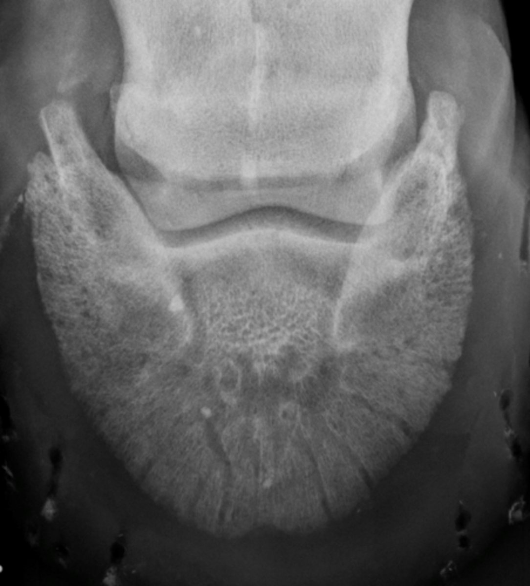 <p>What is highlighted in a 65* DP foot view?</p>