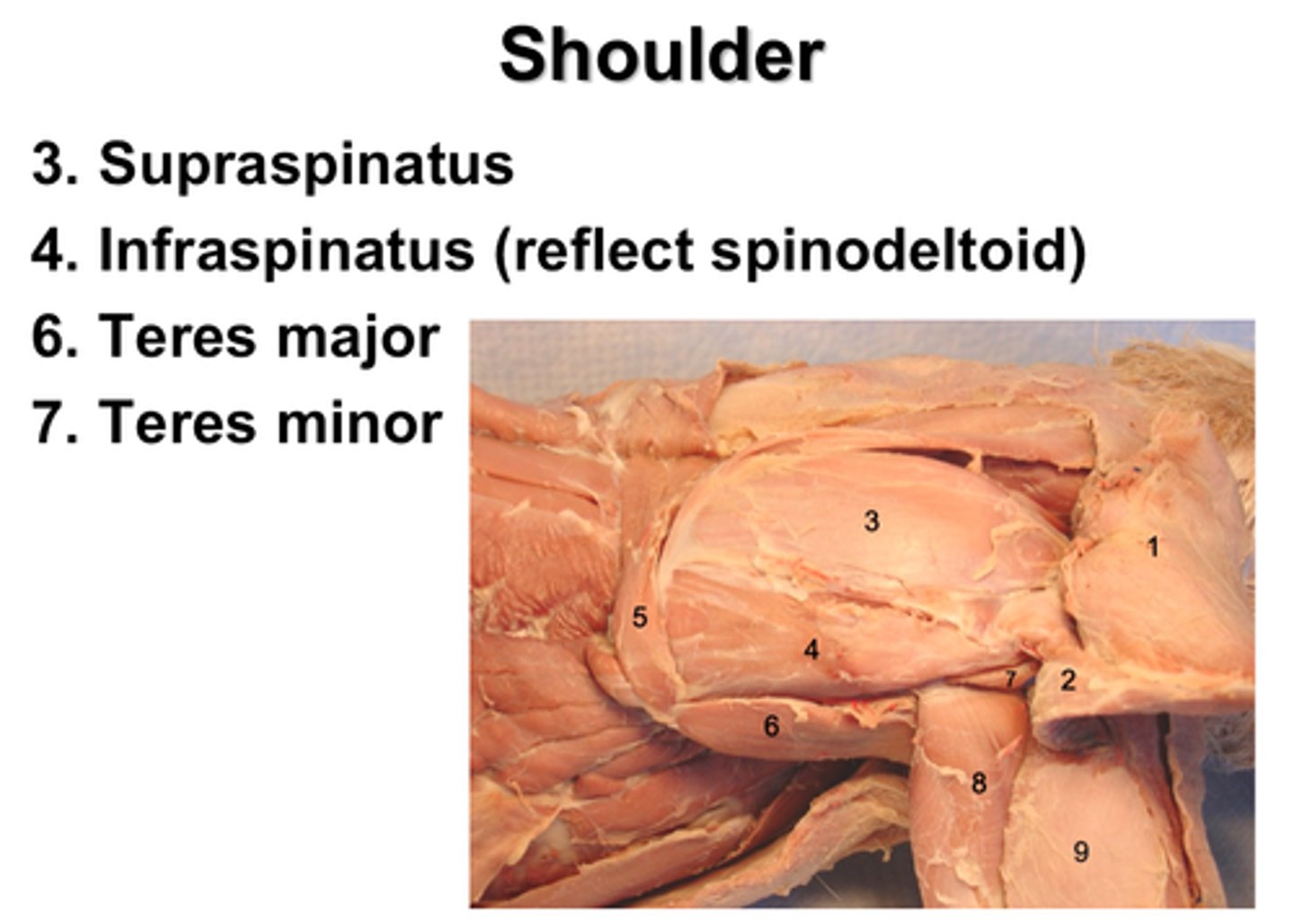 <p>what muscle is indicated by number 7?</p>