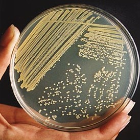 <p>What is shown in this image?</p>