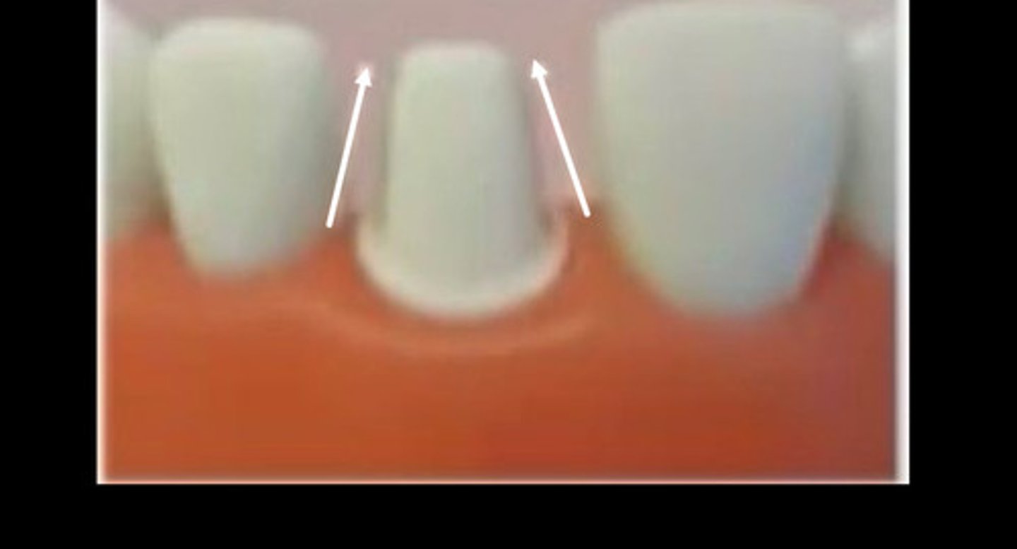 <p>A common error is</p>