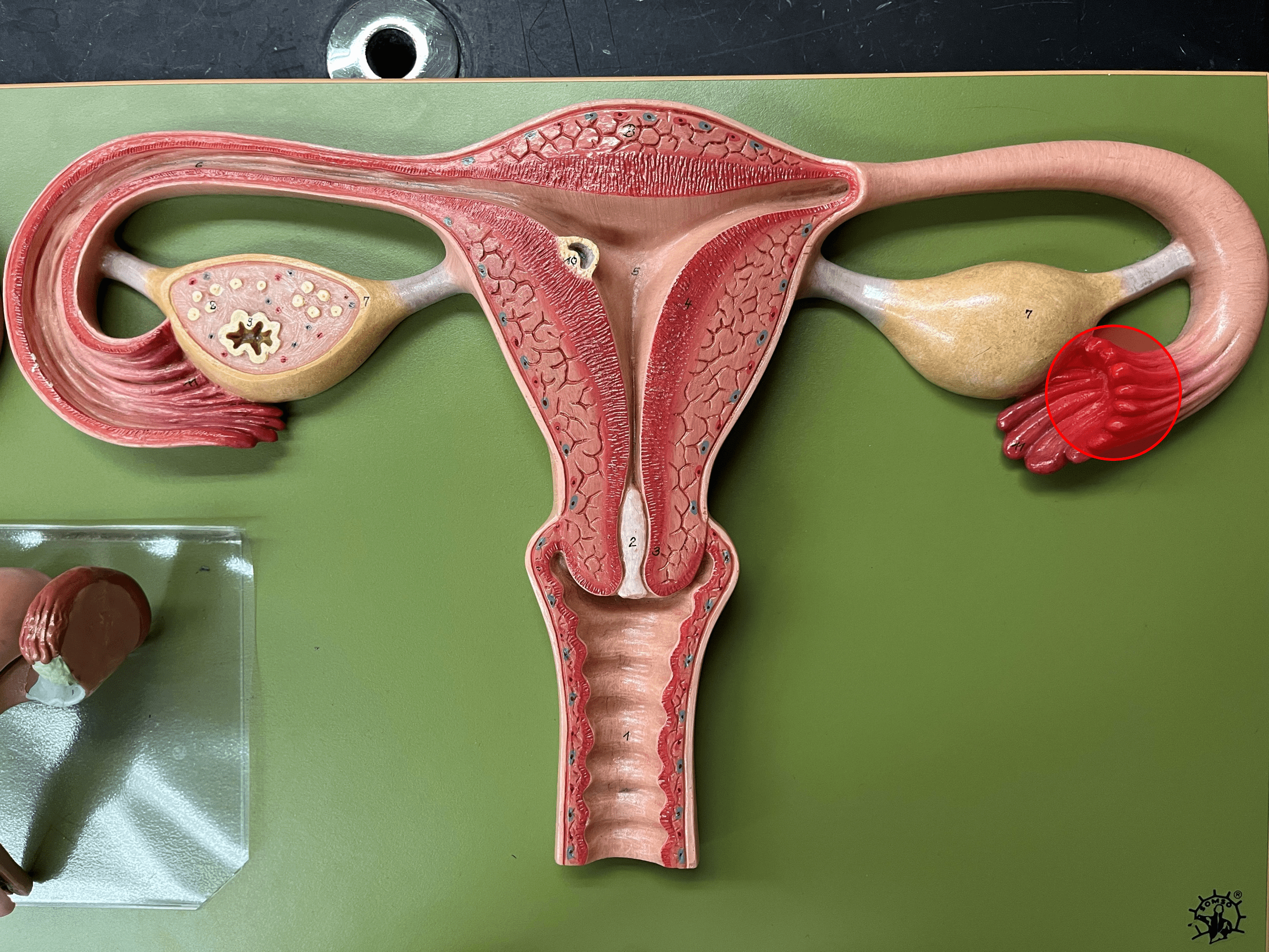 • A region of the uterine tube.

• The funnel-shaped end of the uterine tube at the ovary.

• Contains fimbriae that draw an ovulated oocyte into the uterine tube.