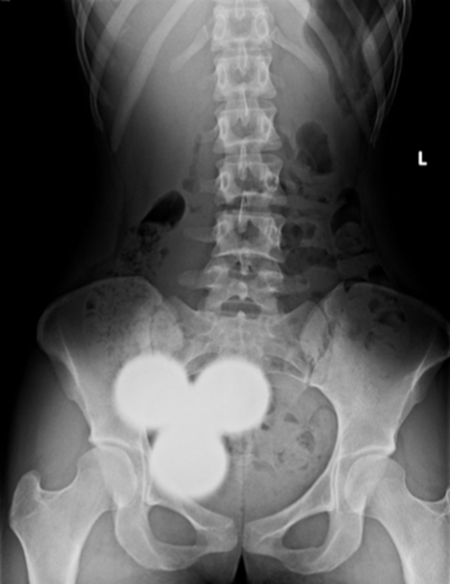 <p>ID view</p>