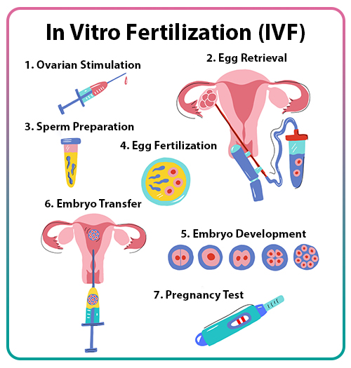 <p>3) in-vitrofertilisatie (IVF)</p>