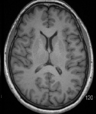 <p>Welche Strukturen sind im T1-Bild hell bzw. dunkel?</p>