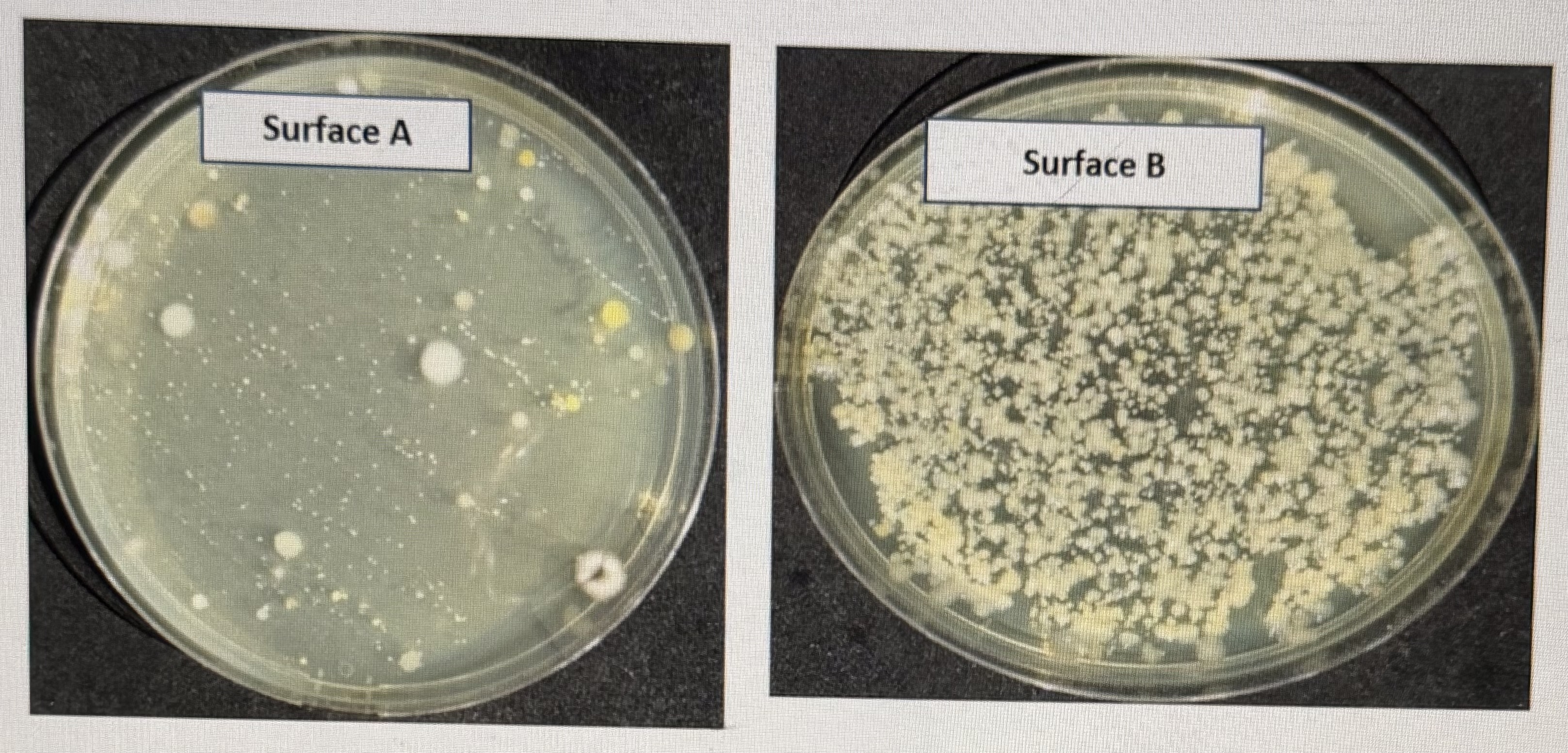 <p>Surface A supports the growth of bacteria</p><p>Surface A shows more growth of organisms than B</p><p>Surface B shows more growth of organisms than A</p><p>Surface A supports the growth of viruses</p>